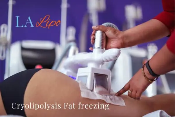 women getting fat freezing Corby