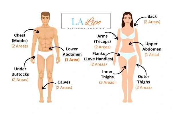 LA LIPO Cryolipolysis Areas Corby