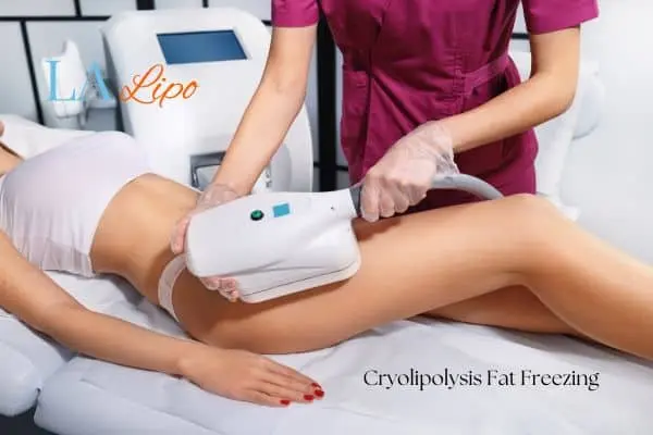 Woman receiving coolsculpting Corby treatment on her thighs