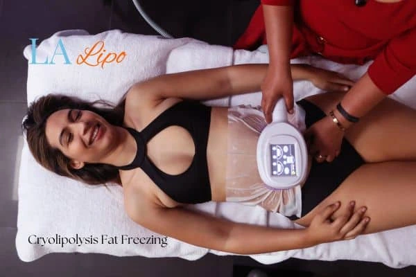woman getting cryolipolysis Corby