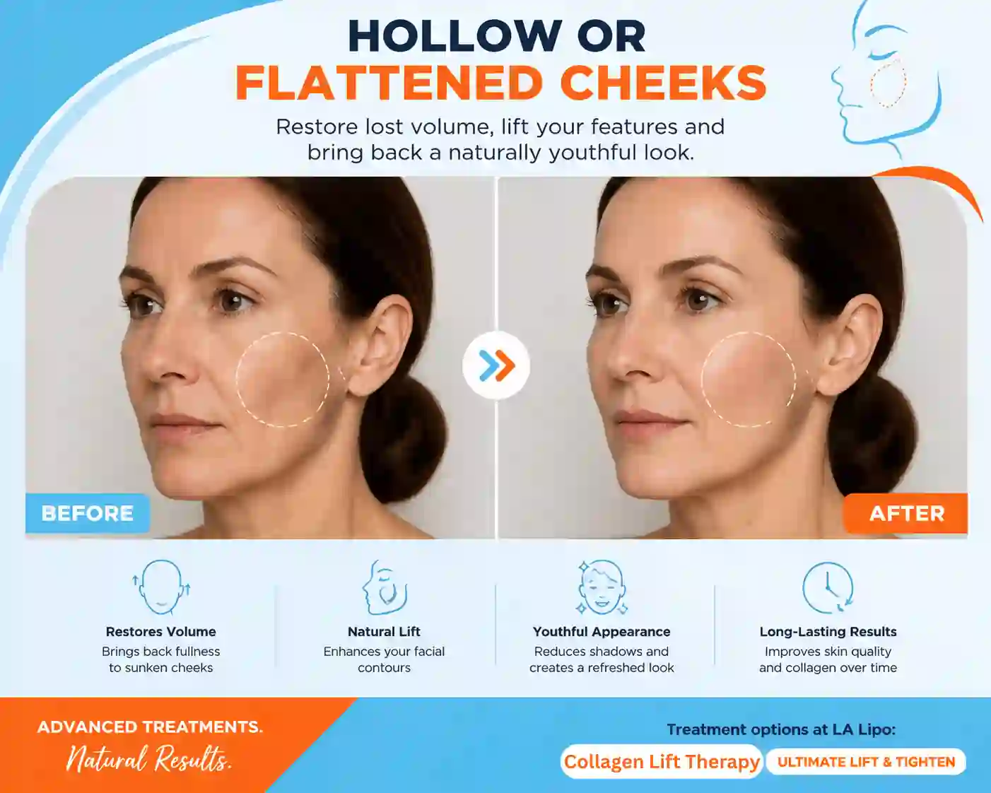 Sign #4: Hollow or Flattened Cheeks Corby