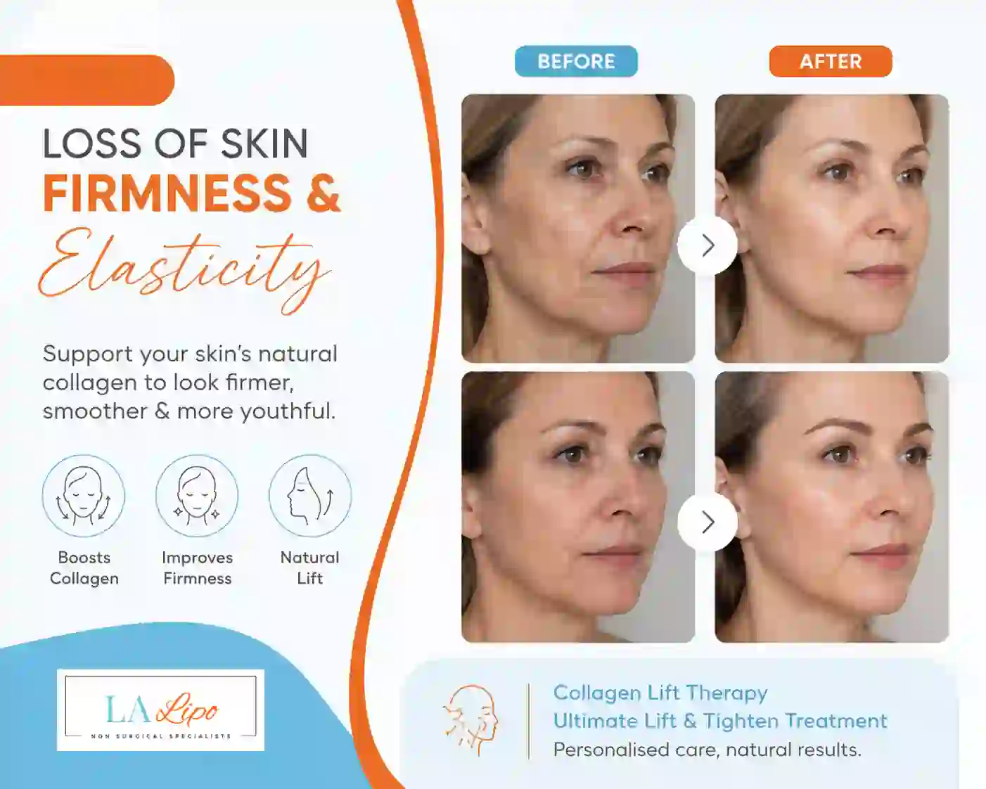 Sign #7: Loss of Skin Firmness and Elasticity Corby